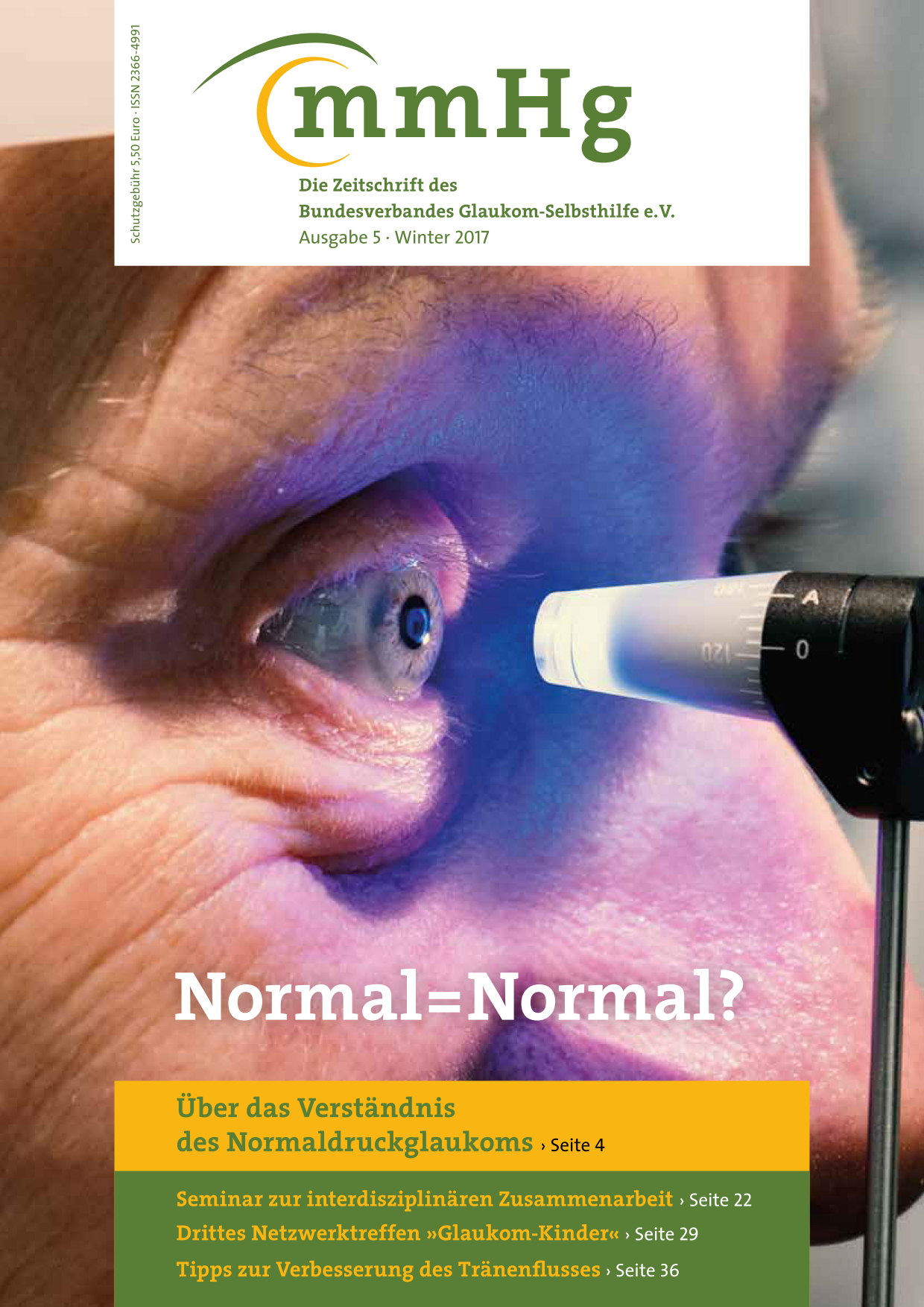 Titelbild Ausgabe 5 - Winter 2017 + Themenheft: Normaldruckglaukom: Nahaufnahme eines Auges das untersucht wird.